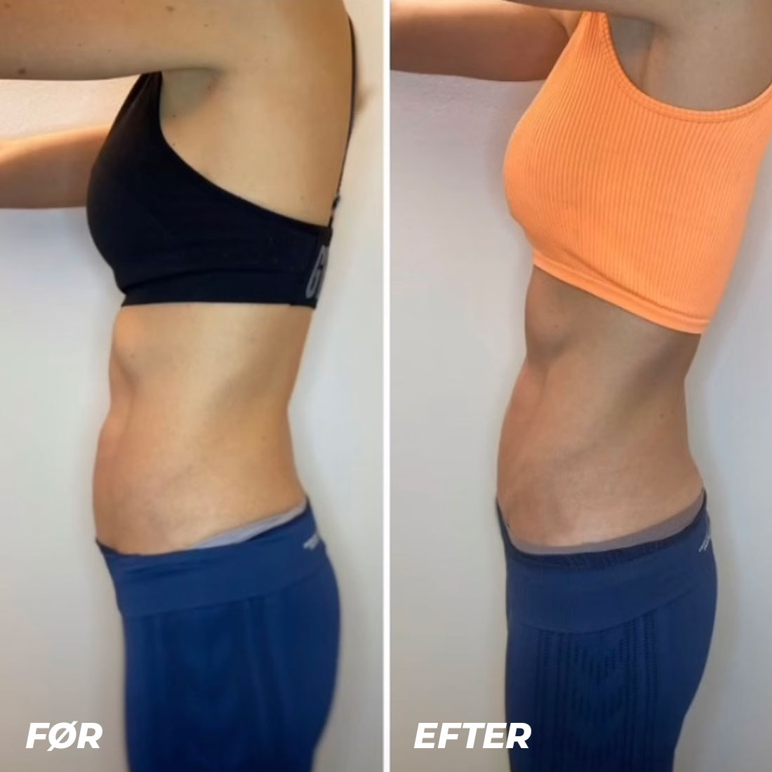 bodysculpting1